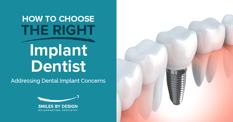 How To Choose The Right Implant Dentist | Dental Implant Concerns